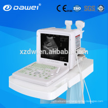 Best portable ultrasound machines for DW360 portable 12 inch LED ultrasound scan machine